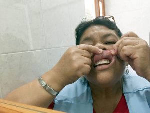 17_febrero_2016_la exploración oral ayuda a prevenir el cáncer bucal